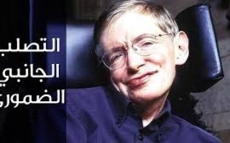 التصلب الجانبي الضموري مرض سريع الانتشار يصيب الجهاز العصبي