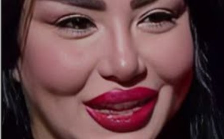 إيمان أيوب: تعرب عن دهشتها من "تنمر" الناس  بسبب حقنة "فيلر”