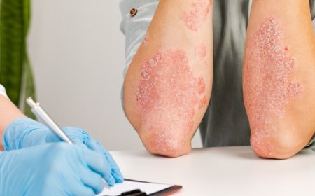 التأثيرات السلبية للفطريات على الجلد: كيف تؤثر على الجسم إذا لم تُعالج في الوقت المناسب؟