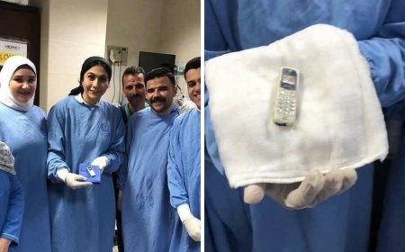 طبيب بالمنصورة ينجح في استخراج هاتف محمول من بطن سجين بعد 6 سنوات