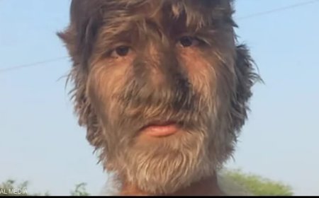 مستذئب « الهند » يحصد غينيس للارقام القياسية