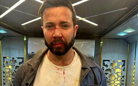 تامر شلتوت يتعرض لعضة حقيقية أثناء تصوير «الغاوي» ويواصل التصوير رغم الإصابة