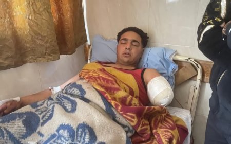 والد الشاب المصاب بهجوم نمر في سيرك طنطا: «ابني كان بيجهز للزفاف وحلمه تدمر بسبب إهمال»