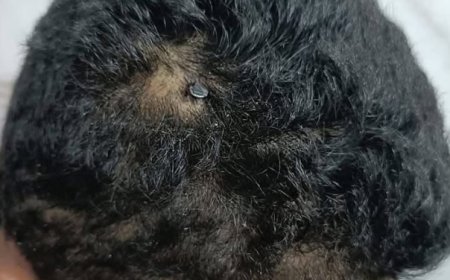 إنقاذ طفل اخترق مسمار معدني جمجمته في مستشفى الفيوم الجامعي