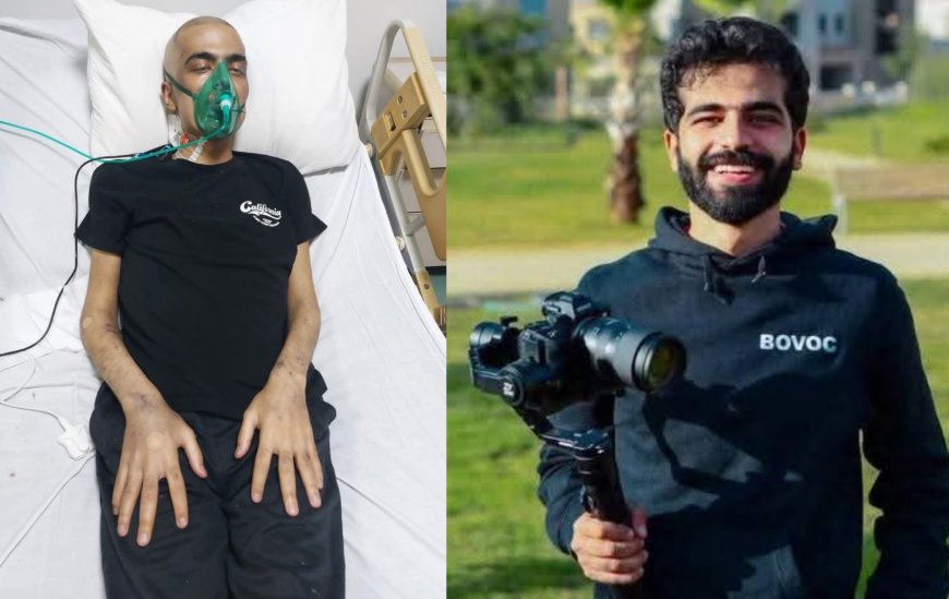 وفاة المصور محمد عبد الله بعد صراع شرس مع اللوكيميا