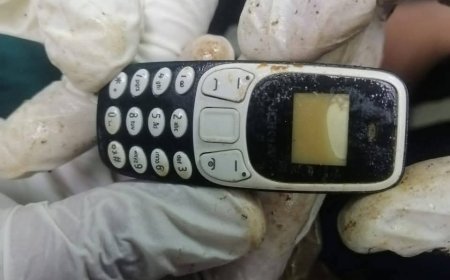 بعد عامين من الألم.. استخراج هاتف محمول من معدة مريض في مستشفى الأزهر بأسيوط دون جراحة