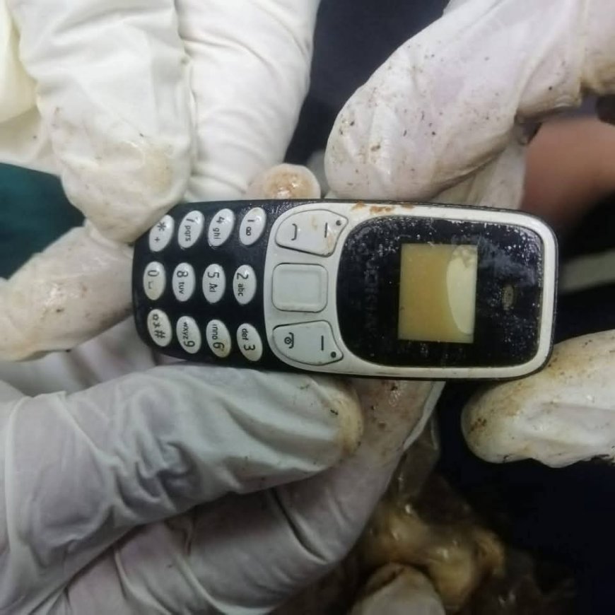 بعد عامين من الألم.. استخراج هاتف محمول من معدة مريض في مستشفى الأزهر بأسيوط دون جراحة