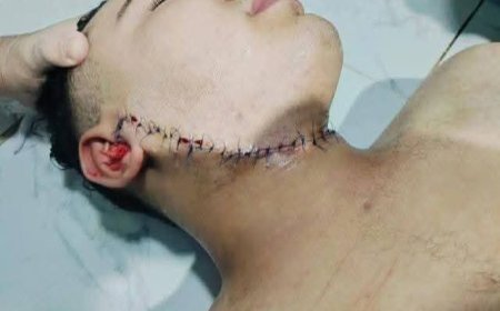 شاب ينجو من الموت بعد اعتداء بلطجي عليه بـ44 غرزة في العجوزة بسبب رفضه دفع إتاوة