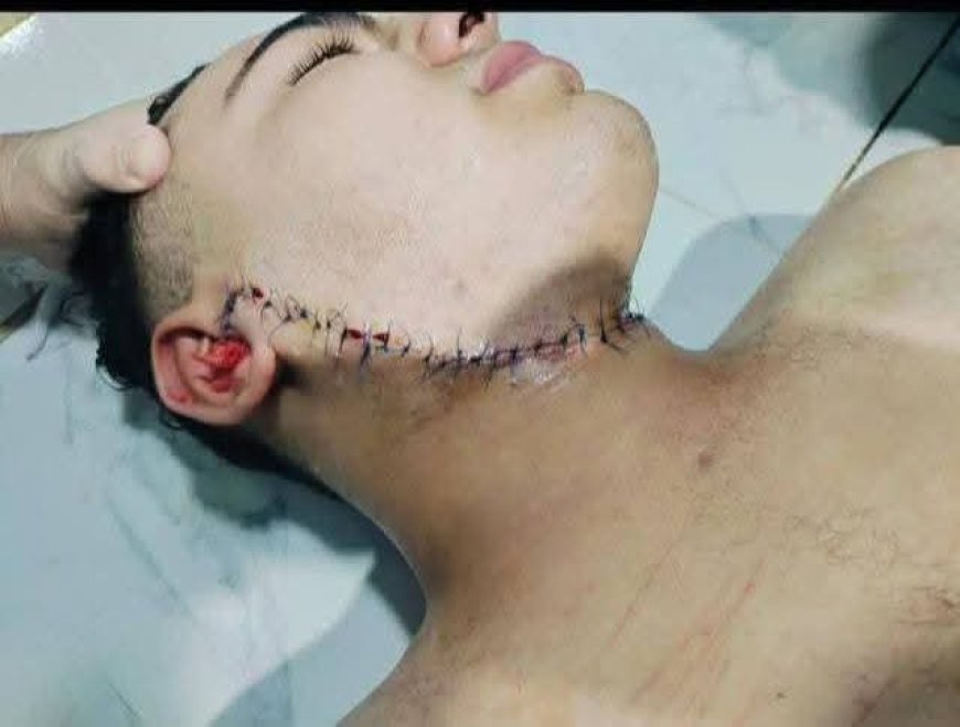 شاب ينجو من الموت بعد اعتداء بلطجي عليه بـ44 غرزة في العجوزة بسبب رفضه دفع إتاوة