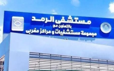 إنقاذ بصر مريضة ببورسعيد بتقنية الأرجون ليزر