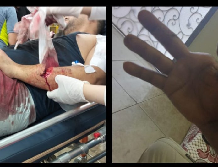 النيابة تأمر بحبس متهم وتطالب بضبط اثنين آخرين في واقعة اعتداء دموي بالمحلة الكبرى