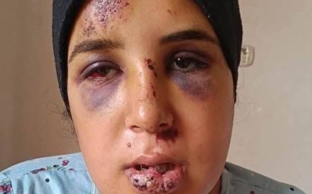 نجاة عروس من تلا من محاولة قتل مروّعة قبل زفافها بشهر