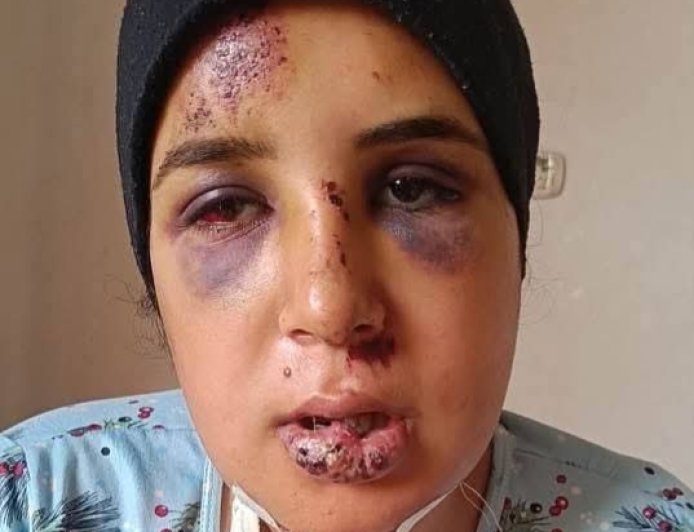 نجاة عروس من تلا من محاولة قتل مروّعة قبل زفافها بشهر