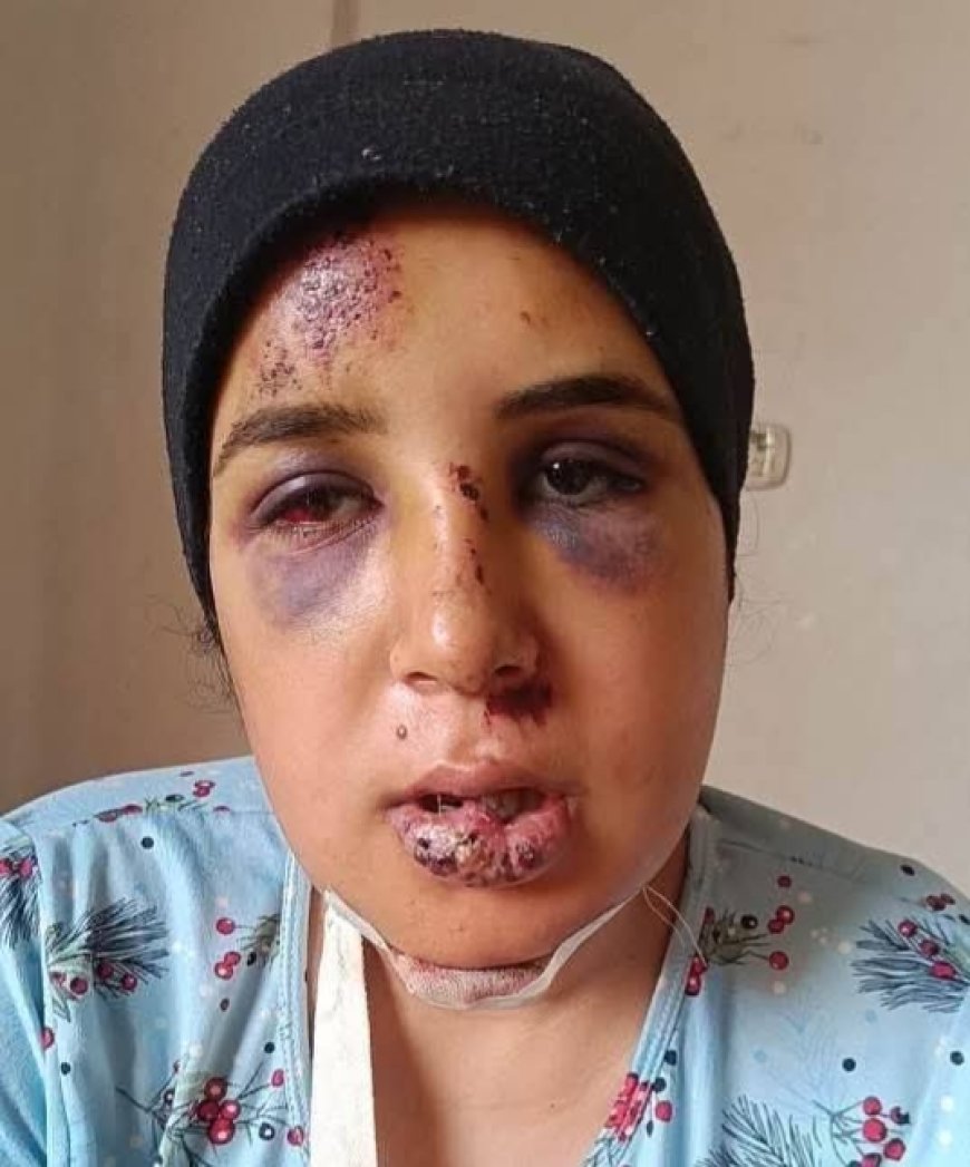 نجاة عروس من تلا من محاولة قتل مروّعة قبل زفافها بشهر